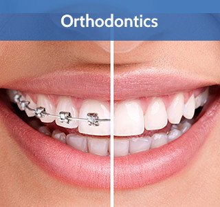 Orthodontics